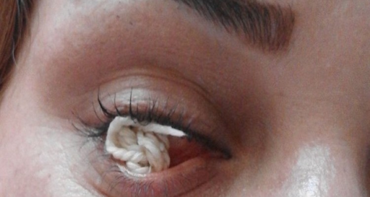 حادثه حیرت انگیز در قوه بینایی بانوی اصلاندوزی/چشمی که نخ تولید می کند+عکس و فیلم