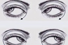 چشم خود را ورزش دهید