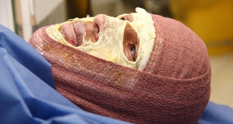 تصاویری وحشتناک با طعم درد و خون از چهارشنبه سوری سال ۹۴ 