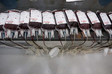 فروش خون و پلاسما توسط افراد بی‌بضاعت تکذیب شد + صوت 