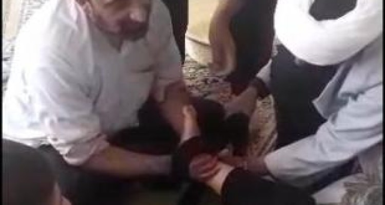 جا انداختن پای کودکی که ۱۵ روزه از شدت درد خوابش نمیبرد