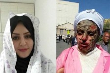 درد دلی صمیمانه با رئیس دستگاه قضا/ انتظاری که قربانیان اسیدپاشی از قوه قضاییه دارند