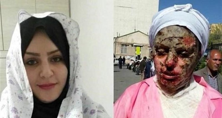 درد دلی صمیمانه با رئیس دستگاه قضا/ انتظاری که قربانیان اسیدپاشی از قوه قضاییه دارند