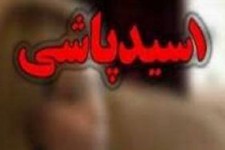 آخرین وضعیت درمان دانش‌ آموز اسلام‌ آبادغربی/ ۹ درصد سوختگی با اسید