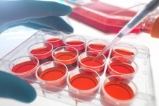 سلول‌های کوچکی که به جنگ بیماری خودایمن می‌روند/ موفقیت دانشمندان ایرانی در مسیر درمان سرطان خون 