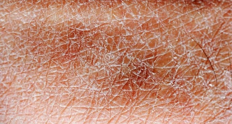 مزایای خواب خوب و تاثیر آن بر سلامت و شادابی پوست 