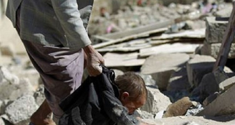 سعودی ها نوچه آمریکا و اسرائیل شده ‌اند / حملات ددمنشانه آل سعود به یمن مغایر با همه قوانین بین ‌المللی است/ مدعیان حقوق بشر بر روی جنایات آل سعود در یمن چشم بسته اند!