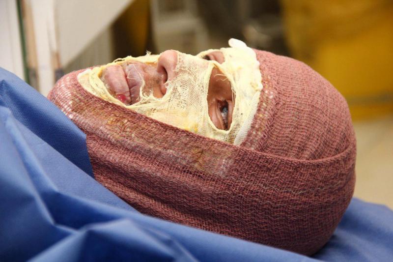 تصاویری وحشتناک با طعم درد و خون از چهارشنبه سوری سال ۹۴ 