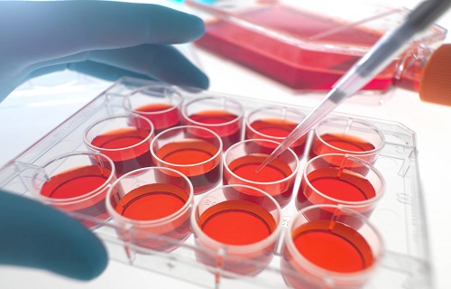 سلول‌های کوچکی که به جنگ بیماری خودایمن می‌روند/ موفقیت دانشمندان ایرانی در مسیر درمان سرطان خون 